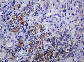 SOAT2 Antibody in Immunohistochemistry (Paraffin) (IHC (P))