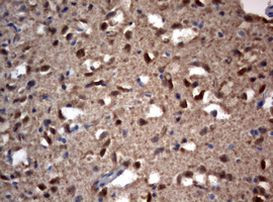 VSNL1 Antibody in Immunohistochemistry (Paraffin) (IHC (P))