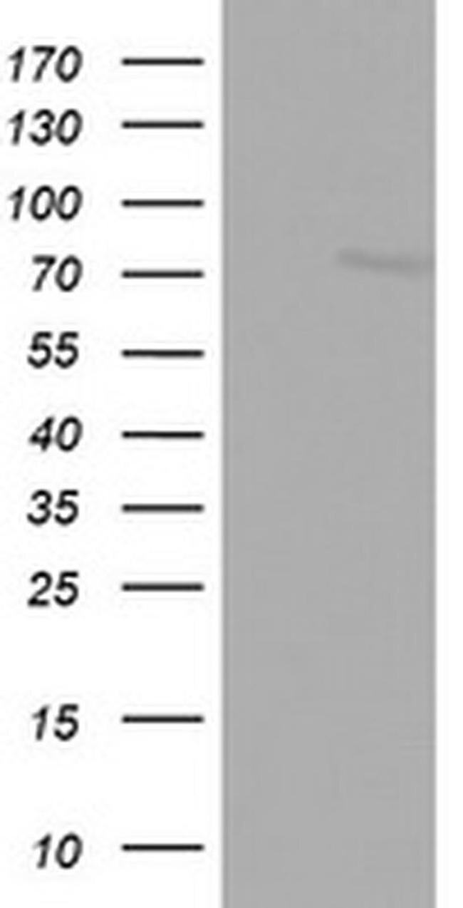 FBXO11 Antibody in Western Blot (WB)