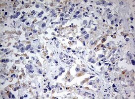 SPATA2L Antibody in Immunohistochemistry (Paraffin) (IHC (P))