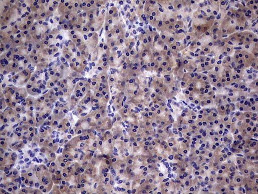 TGIF Antibody in Immunohistochemistry (Paraffin) (IHC (P))