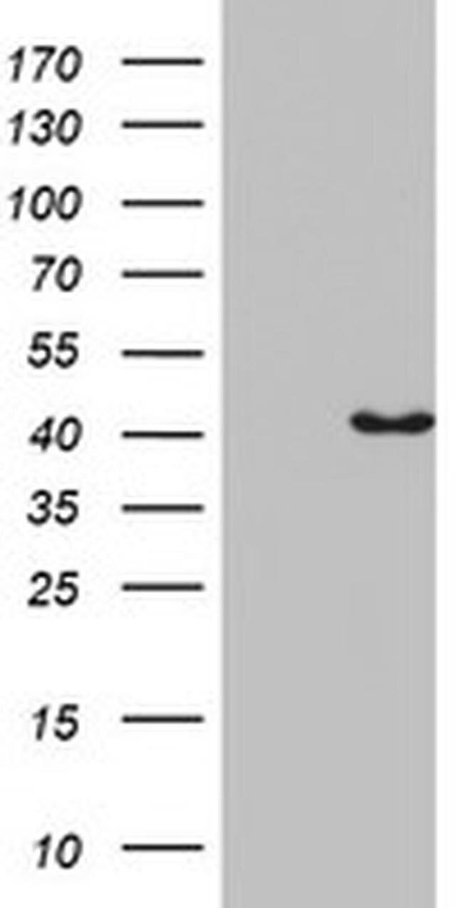 Pleckstrin 2 Antibody in Western Blot (WB)