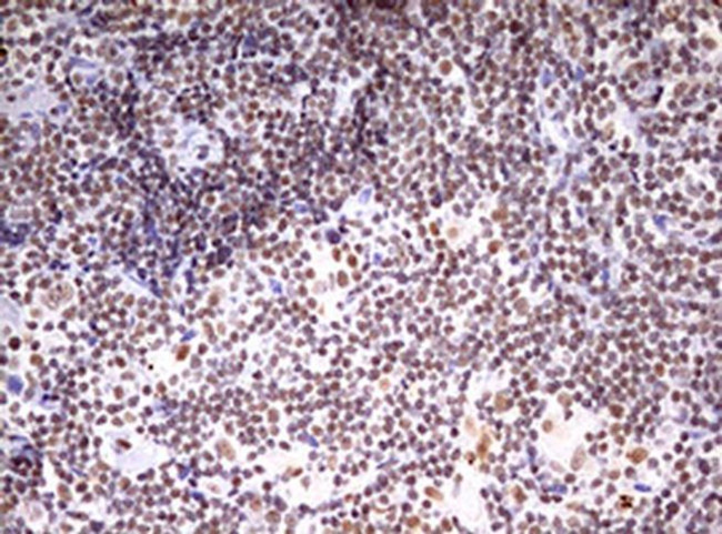 CDCA7L Antibody in Immunohistochemistry (Paraffin) (IHC (P))