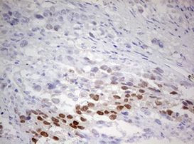 TIPIN Antibody in Immunohistochemistry (Paraffin) (IHC (P))