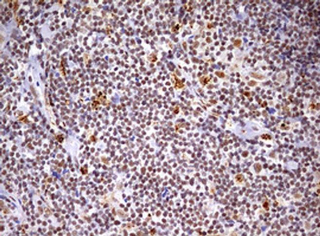 CDCA7L Antibody in Immunohistochemistry (Paraffin) (IHC (P))