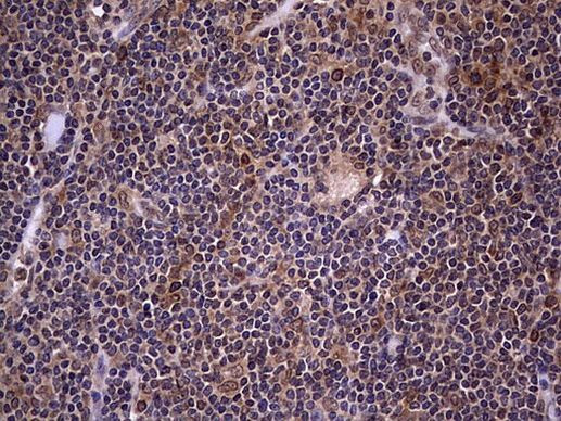 ZNF286A Antibody in Immunohistochemistry (Paraffin) (IHC (P))