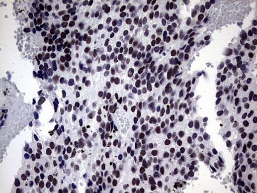 ZNF34 Antibody in Immunohistochemistry (Paraffin) (IHC (P))