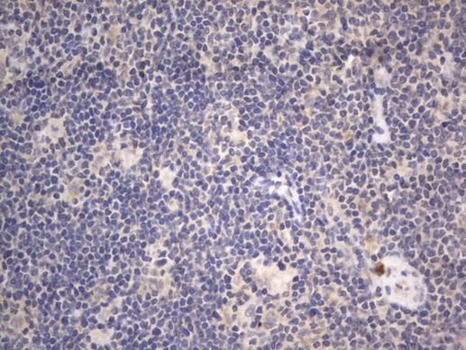 DDOST Antibody in Immunohistochemistry (Paraffin) (IHC (P))