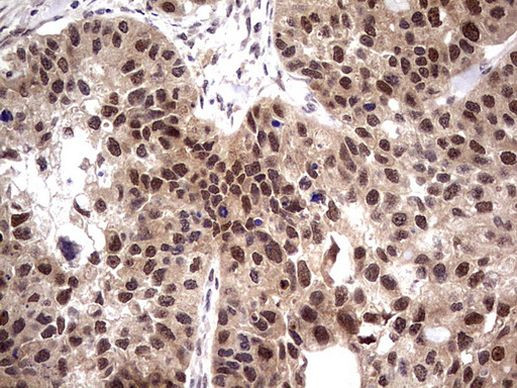 PPIL1 Antibody in Immunohistochemistry (Paraffin) (IHC (P))