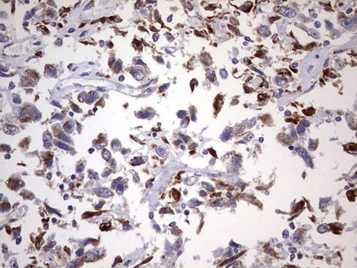 PPP2R5D Antibody in Immunohistochemistry (Paraffin) (IHC (P))