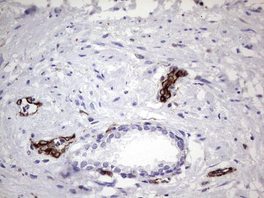 PPP2R5D Antibody in Immunohistochemistry (Paraffin) (IHC (P))