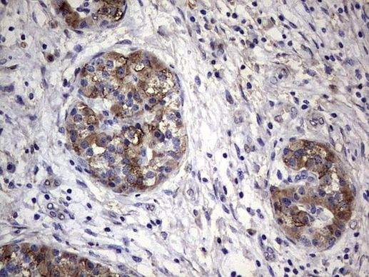 FAF1 Antibody in Immunohistochemistry (Paraffin) (IHC (P))
