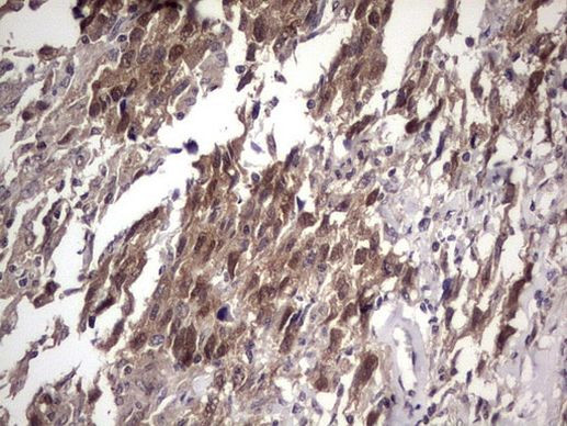 FAF1 Antibody in Immunohistochemistry (Paraffin) (IHC (P))