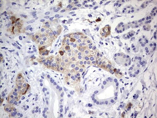 N4BP2L2 Antibody in Immunohistochemistry (Paraffin) (IHC (P))
