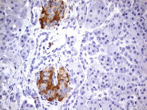 BFSP2 Antibody in Immunohistochemistry (Paraffin) (IHC (P))