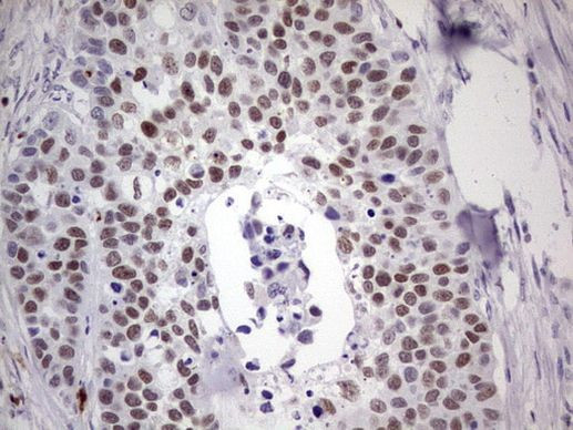 IKZF3 Antibody in Immunohistochemistry (Paraffin) (IHC (P))