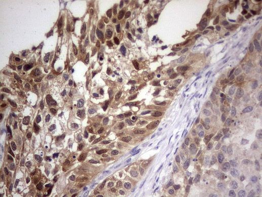 PAFAH1B3 Antibody in Immunohistochemistry (Paraffin) (IHC (P))