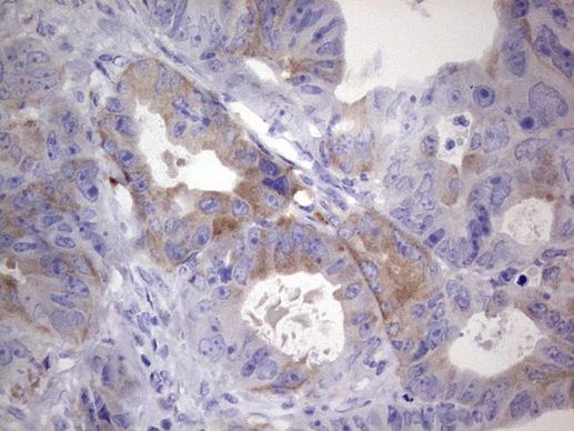 RRM1 Antibody in Immunohistochemistry (Paraffin) (IHC (P))
