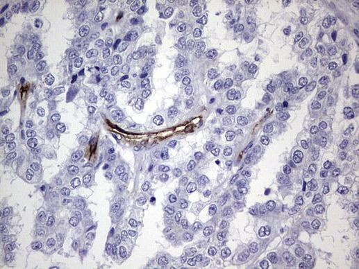 CDH4 Antibody in Immunohistochemistry (Paraffin) (IHC (P))