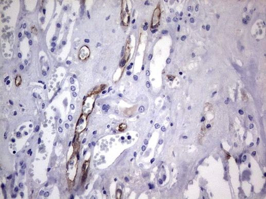 CDH4 Antibody in Immunohistochemistry (Paraffin) (IHC (P))