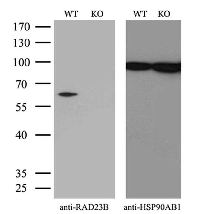 RAD23B Antibody in Western Blot (WB)