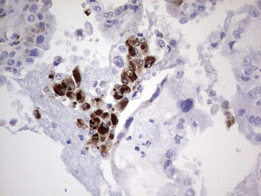 NOR-1 Antibody in Immunohistochemistry (Paraffin) (IHC (P))
