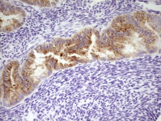 LPIN3 Antibody in Immunohistochemistry (Paraffin) (IHC (P))