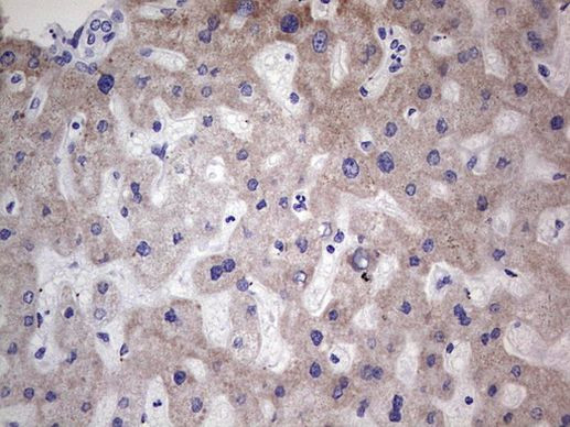 MB67 Antibody in Immunohistochemistry (Paraffin) (IHC (P))