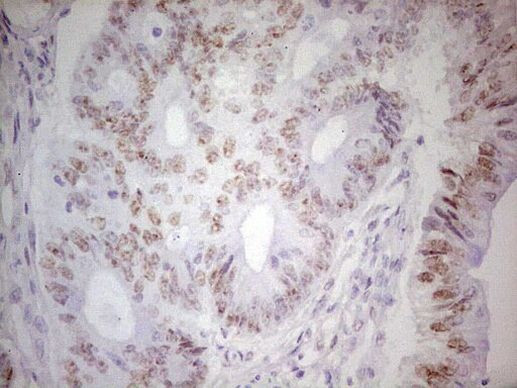 TRIB1 Antibody in Immunohistochemistry (Paraffin) (IHC (P))