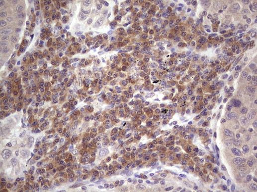 Aspartoacylase Antibody in Immunohistochemistry (Paraffin) (IHC (P))
