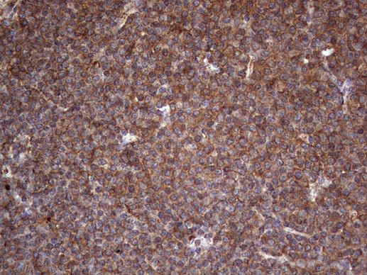 LRRTM1 Antibody in Immunohistochemistry (Paraffin) (IHC (P))