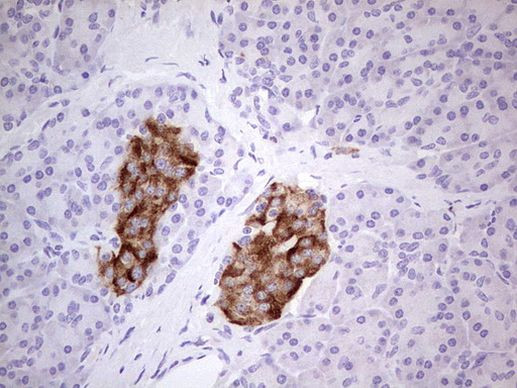 MTF1 Antibody in Immunohistochemistry (Paraffin) (IHC (P))