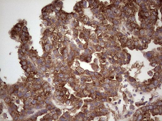 CDKL2 Antibody in Immunohistochemistry (Paraffin) (IHC (P))