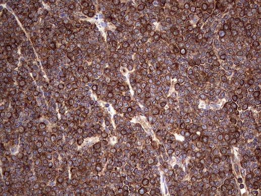 LRRTM1 Antibody in Immunohistochemistry (Paraffin) (IHC (P))