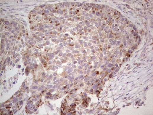 CDKL1 Antibody in Immunohistochemistry (Paraffin) (IHC (P))