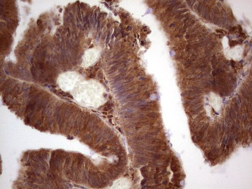 GEMIN8 Antibody in Immunohistochemistry (Paraffin) (IHC (P))