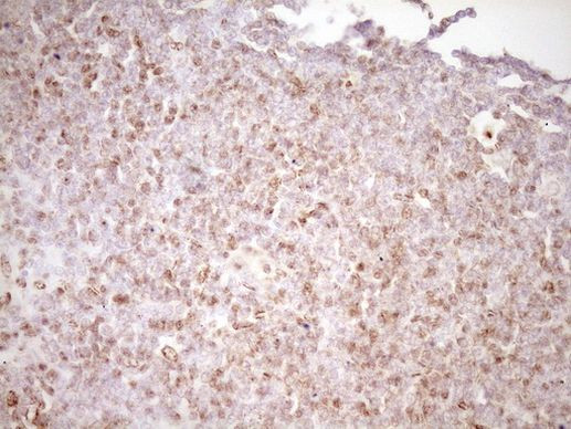 LPIN1 Antibody in Immunohistochemistry (Paraffin) (IHC (P))