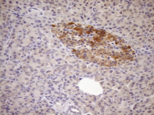 FSIP1 Antibody in Immunohistochemistry (Paraffin) (IHC (P))