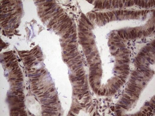 GLI4 Antibody in Immunohistochemistry (Paraffin) (IHC (P))