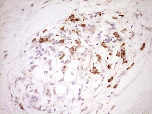 NR0B2 Antibody in Immunohistochemistry (Paraffin) (IHC (P))