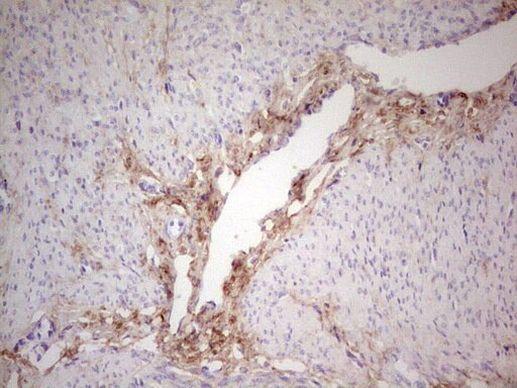 CK1 gamma-1 Antibody in Immunohistochemistry (Paraffin) (IHC (P))