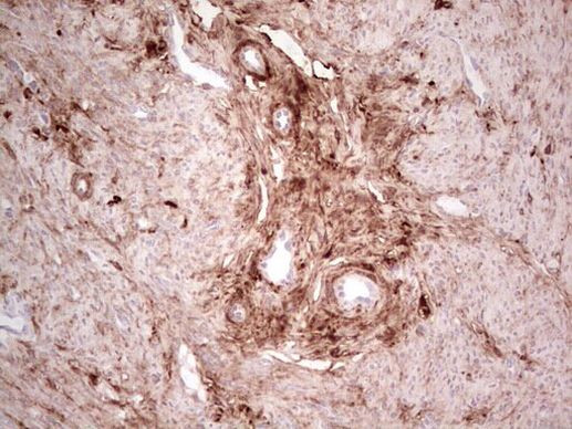 CK1 gamma-1 Antibody in Immunohistochemistry (Paraffin) (IHC (P))