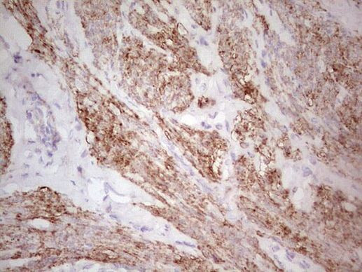 CK1 gamma-1 Antibody in Immunohistochemistry (Paraffin) (IHC (P))