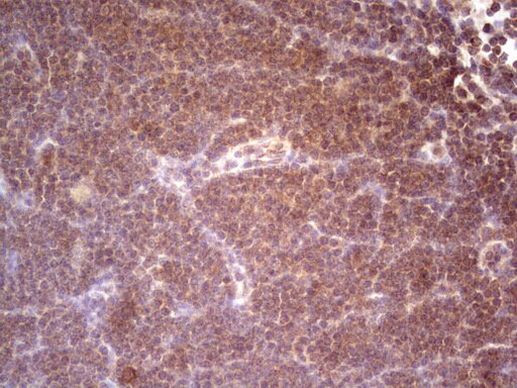 SYNM Antibody in Immunohistochemistry (Paraffin) (IHC (P))