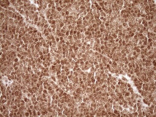 NUDT21 Antibody in Immunohistochemistry (Paraffin) (IHC (P))