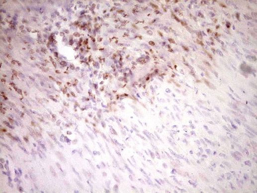 Stabilin 2 Antibody in Immunohistochemistry (Paraffin) (IHC (P))