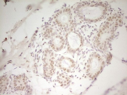 HMG20A Antibody in Immunohistochemistry (Paraffin) (IHC (P))