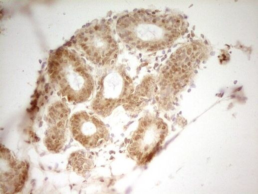 HMG20A Antibody in Immunohistochemistry (Paraffin) (IHC (P))