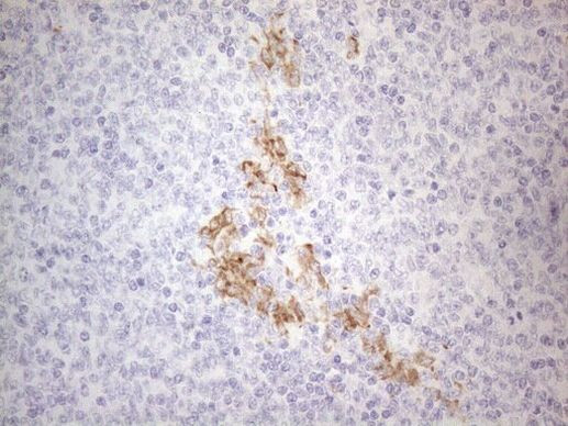 APOB48R Antibody in Immunohistochemistry (Paraffin) (IHC (P))
