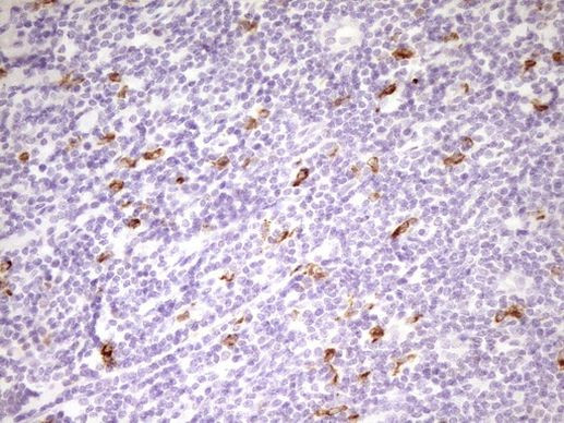 APOB48R Antibody in Immunohistochemistry (Paraffin) (IHC (P))